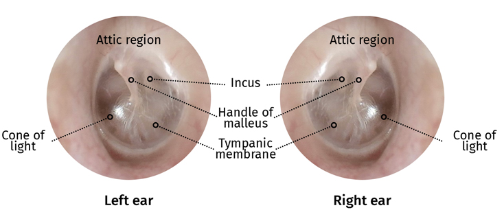 Visual representation of the eardrums